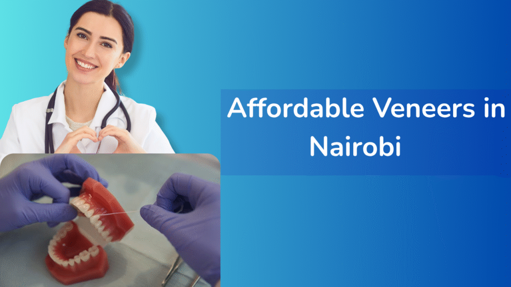 Affordable veneers in Nairobi for a confident, budget-friendly smile makeover