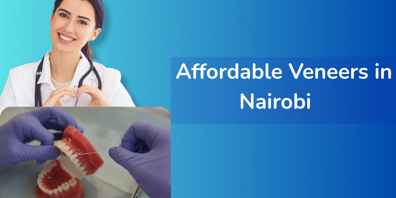 Affordable veneers in Nairobi for a confident, budget-friendly smile makeover Affordable veneers in Nairobi for a confident, budget-friendly smile makeover